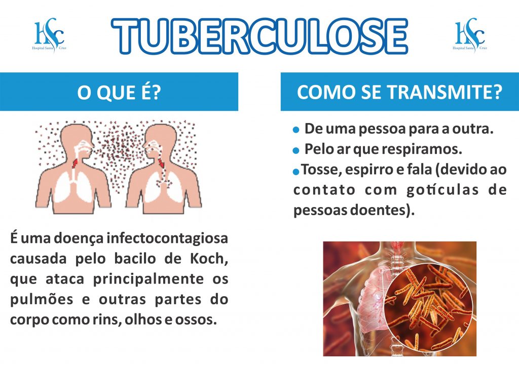 Como curar a tuberculose, em RDR 2: há uma cura para a doença?